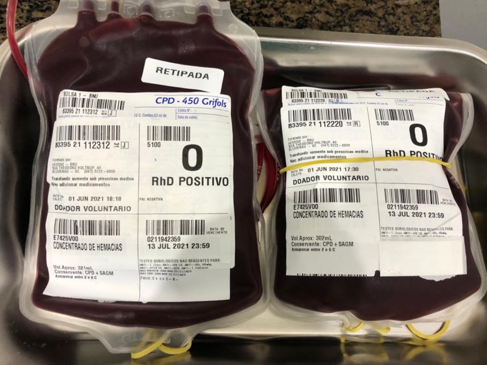 Bolsas de hemocomponentes para a realização da transfusão em pacientes de Navegantes